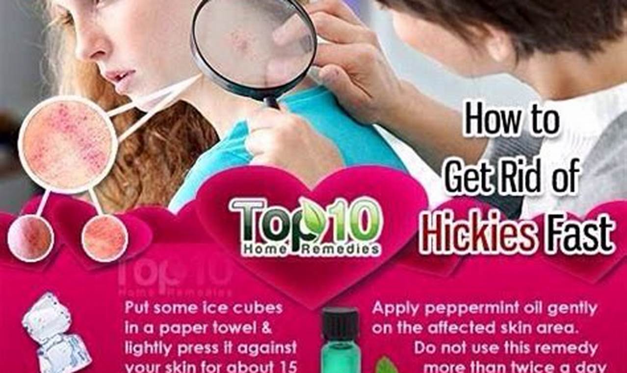 The Ultimate Guide to Concealing Hickeys: Expert Tips and Tricks