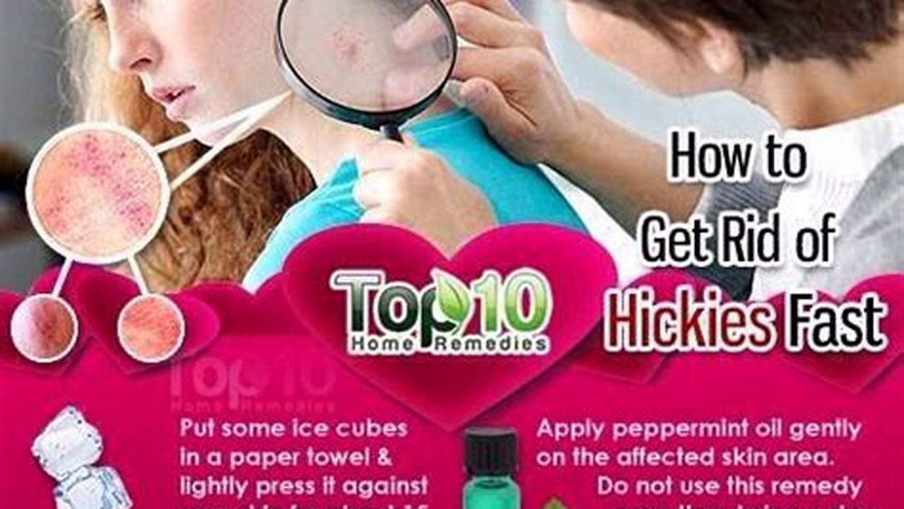 The Ultimate Guide to Concealing Hickeys: Expert Tips and Tricks