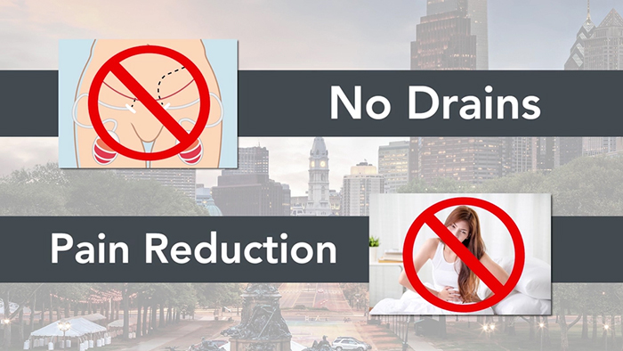 Methods to Scale back Drainage After Tummy Tuck A Information