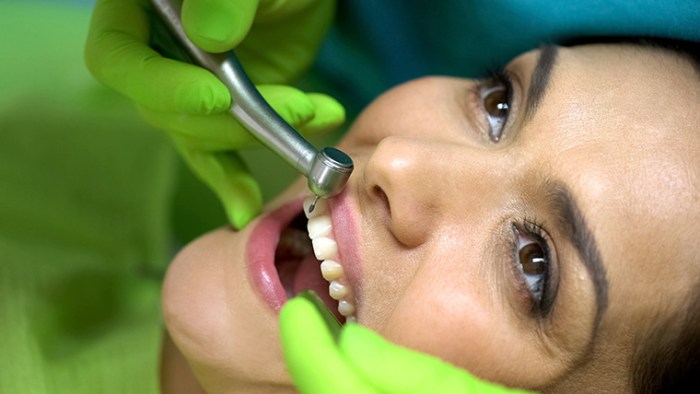 How much does it cost to fix a chipped tooth