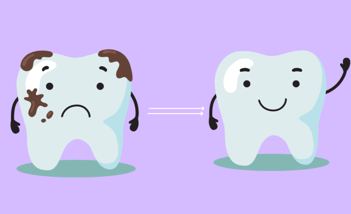 How to get rid of black stains on teeth