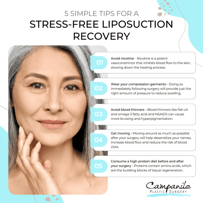 Get Liposuction for Free A Lifelike Information