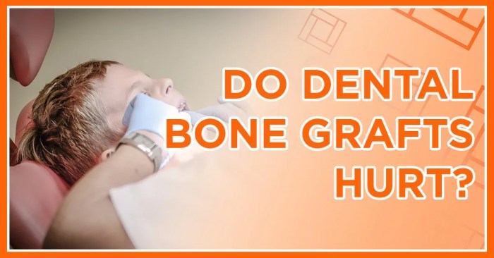 How Lengthy Does Bone Graft Take to Heal? A Complete Information