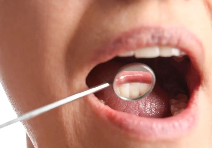Misleading Dental Visits How you can Stop Dentist from Understanding You Smoke