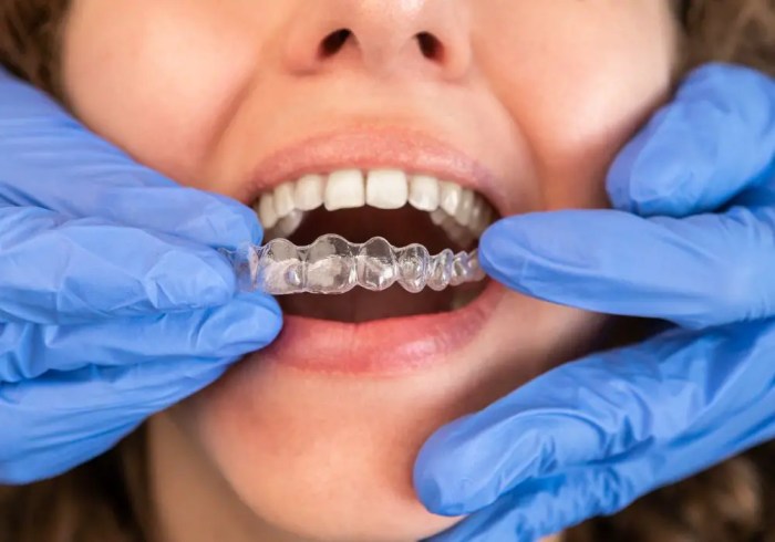 How to soothe sore teeth from retainer