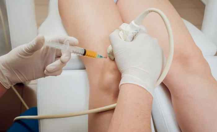PRP Injections Train Timing Defined