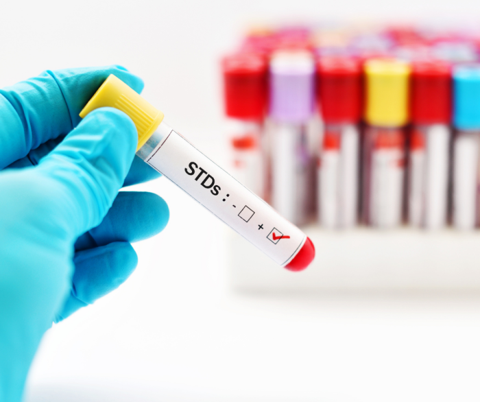 Pressing Care STD Testing Insurance coverage Protection