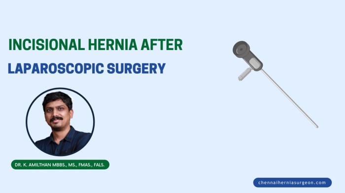 Hernia repair laparoscopic inguinal surgery recovery How to avoid hernia after laparoscopic surgery