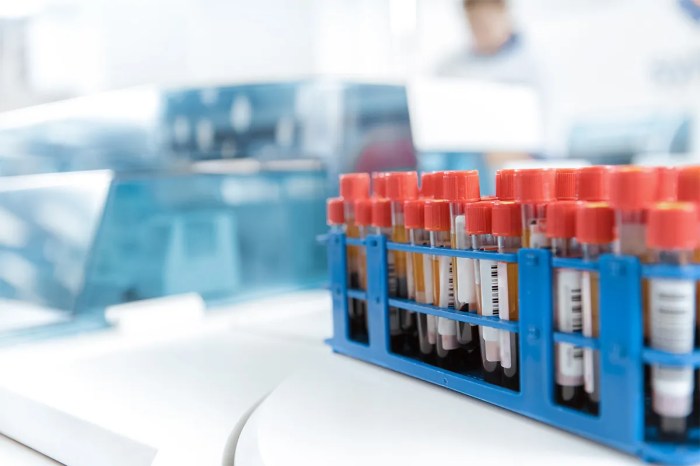 How often to get blood work
