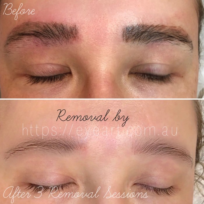 How to get rid of microblading