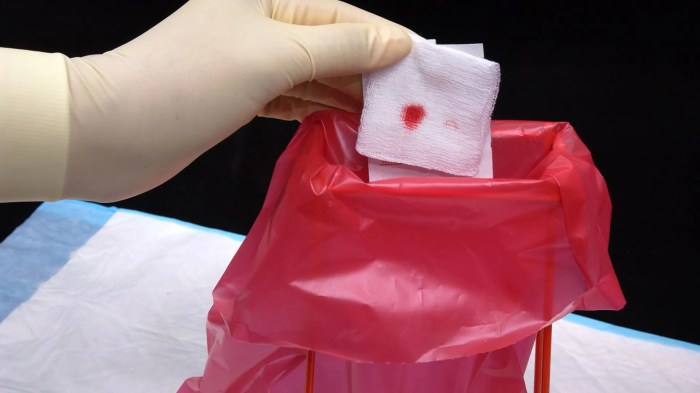 How long to leave gauze in after tooth pulled