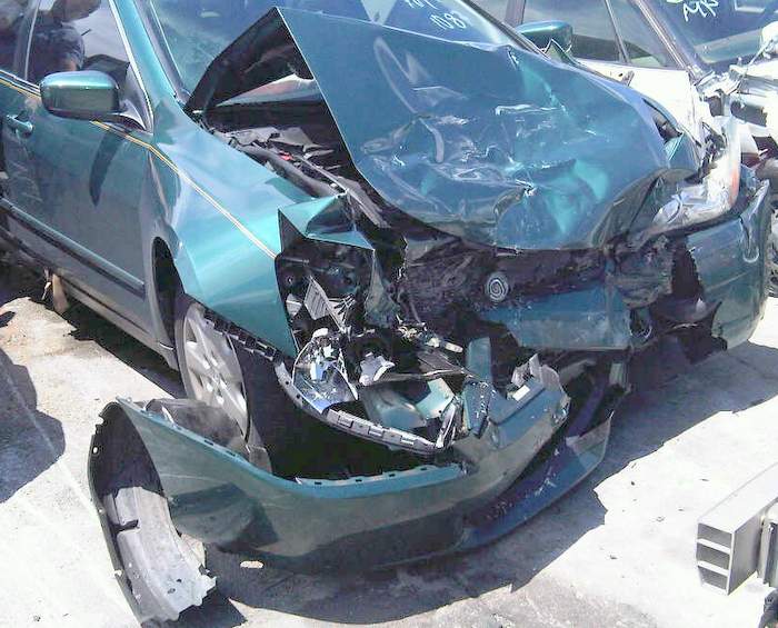Driving after knee replacement surgery car insurance