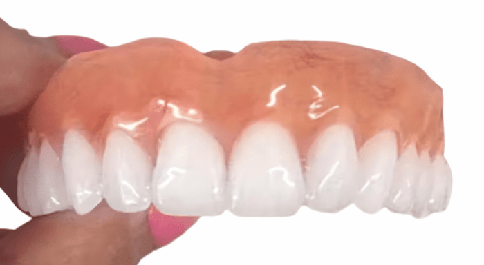 How long does it take to get false teeth