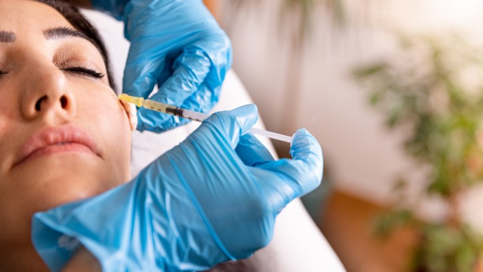 How Lengthy Does Filler Settle?  The Filler Repair
