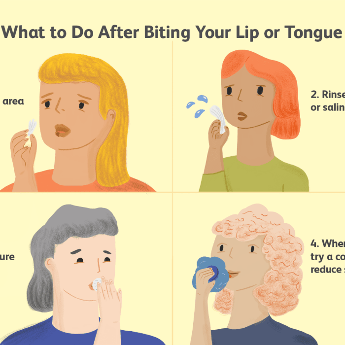 How to cure a lip bite