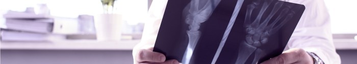 Pressing Care X-Ray Price With out Insurance coverage A Information
